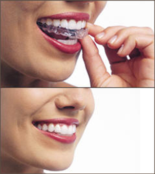 Braces Dentists Invisalign Kansas Staff-pic